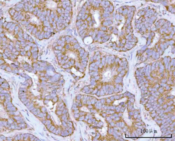 NDUFAF4 Rabbit Polyclonal Antibody