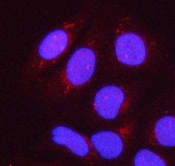 PPP1R15B Rabbit Polyclonal Antibody