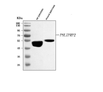 PNLIPRP2 Rabbit Polyclonal Antibody