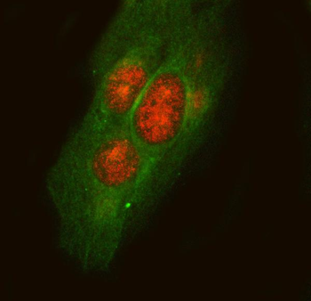 LYPLA3/PLA2G15 Antibody