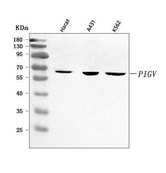 PIGV Rabbit Polyclonal Antibody