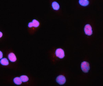 PRMT1 Rabbit Polyclonal Antibody