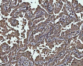 PPP4C Rabbit Polyclonal Antibody