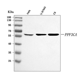 PPP3CA Rabbit Polyclonal Antibody