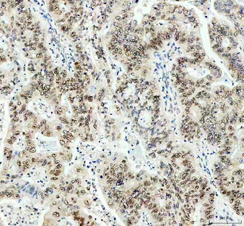 PPP2R5D Rabbit Polyclonal Antibody