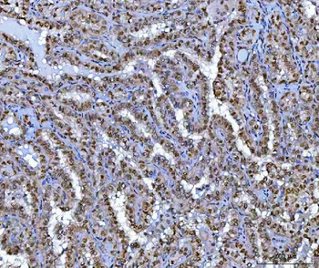 BCL11B Rabbit Polyclonal Antibody