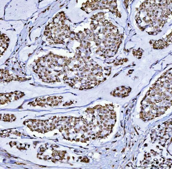 BCL11B Rabbit Polyclonal Antibody