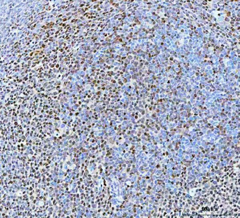 BCL11B Rabbit Polyclonal Antibody