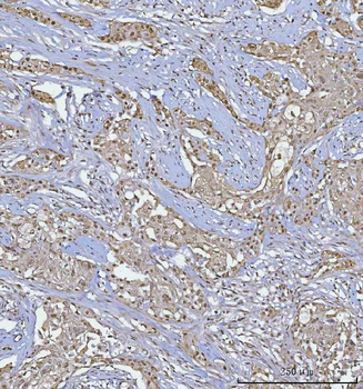 BCL11B Rabbit Polyclonal Antibody