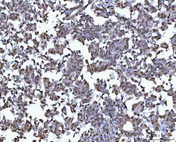 BCL11B Rabbit Polyclonal Antibody