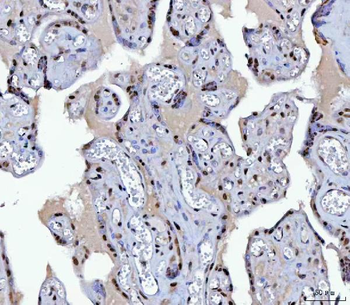 BCL11B Rabbit Polyclonal Antibody