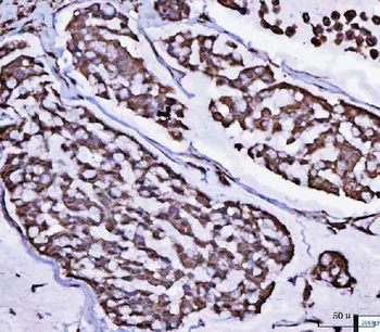 POLR1B Rabbit Polyclonal Antibody