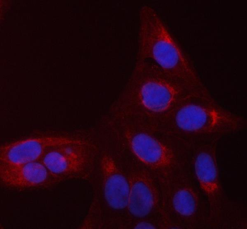 CDC42 Rabbit Polyclonal Antibody