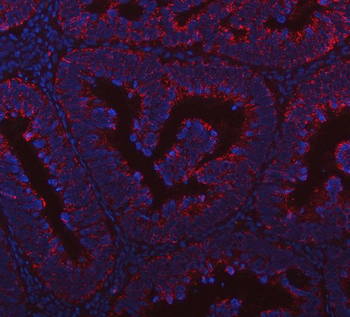 PRDM15 Rabbit Polyclonal Antibody