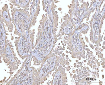 PRDM15 Rabbit Polyclonal Antibody