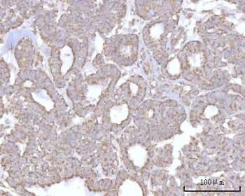 PRDM15 Rabbit Polyclonal Antibody