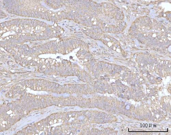PRDM15 Rabbit Polyclonal Antibody