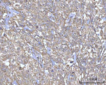 PRDM15 Rabbit Polyclonal Antibody