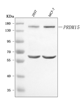 PRDM15 Rabbit Polyclonal Antibody