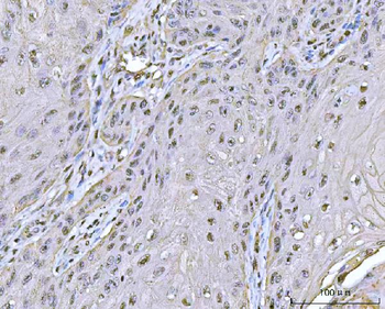 PPM1G Rabbit Polyclonal Antibody