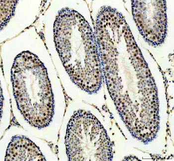 PPM1G Rabbit Polyclonal Antibody