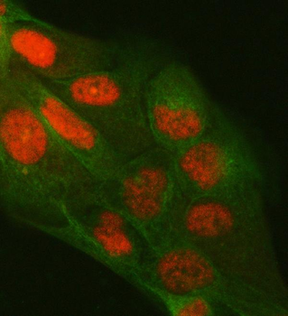 PPM1G Rabbit Polyclonal Antibody