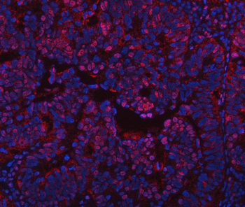 PPM1G Rabbit Polyclonal Antibody