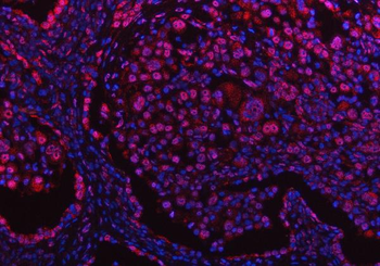 PPM1G Rabbit Polyclonal Antibody