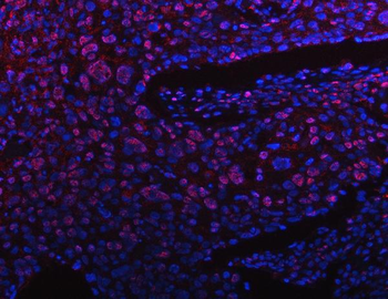 PPM1G Rabbit Polyclonal Antibody