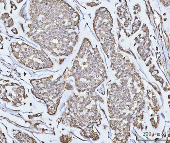 PPM1G Rabbit Polyclonal Antibody