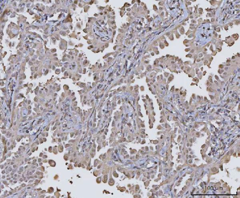 PPM1G Rabbit Polyclonal Antibody