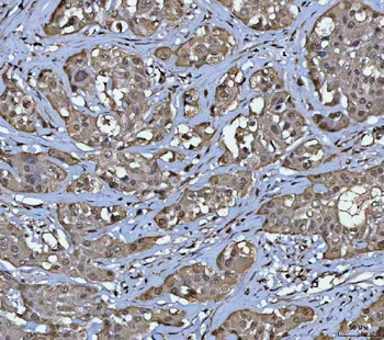 PPM1G Rabbit Polyclonal Antibody