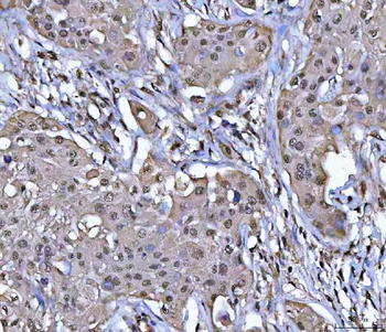 PPM1G Rabbit Polyclonal Antibody