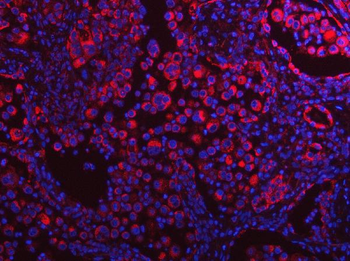 PLEKHA1 Rabbit Polyclonal Antibody