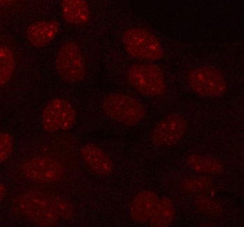 PLEKHA1 Rabbit Polyclonal Antibody