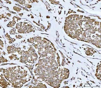 PLEKHA1 Rabbit Polyclonal Antibody