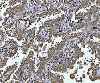 PLEKHA1 Rabbit Polyclonal Antibody