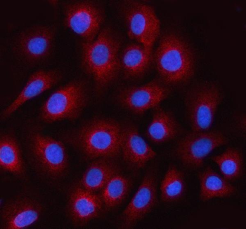 STRADB Rabbit Polyclonal Antibody