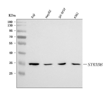 STRADB Rabbit Polyclonal Antibody