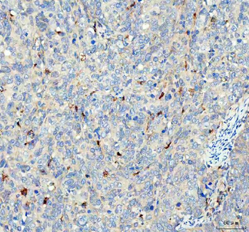 GPX1 Rabbit Polyclonal Antibody