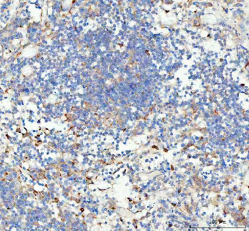 GPX1 Rabbit Polyclonal Antibody