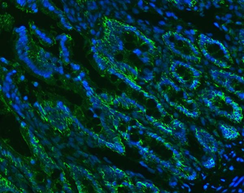 CD326/Epcam Rabbit Polyclonal Antibody