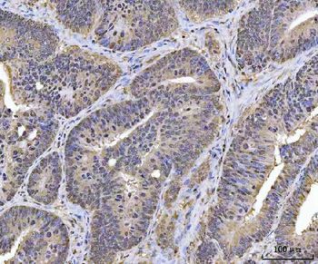 PLEKHG5 Rabbit Polyclonal Antibody