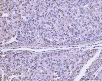 PLEKHG5 Rabbit Polyclonal Antibody