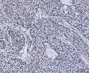 PLEKHG5 Rabbit Polyclonal Antibody