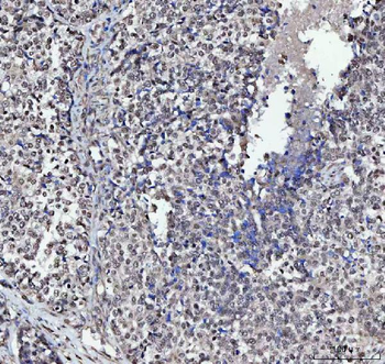PLEKHG5 Rabbit Polyclonal Antibody