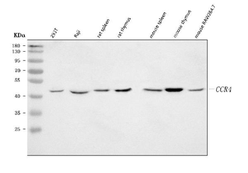 CCR4 Rabbit Polyclonal Antibody