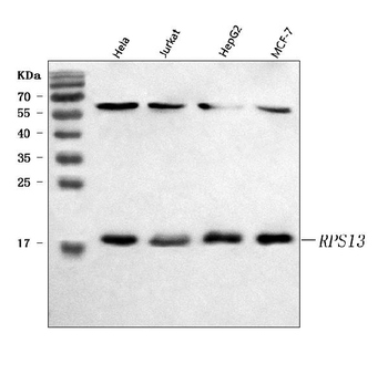 RPS13 Rabbit Polyclonal Antibody