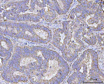 Renin/REN Rabbit Polyclonal Antibody