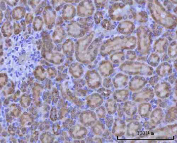 Renin/REN Rabbit Polyclonal Antibody